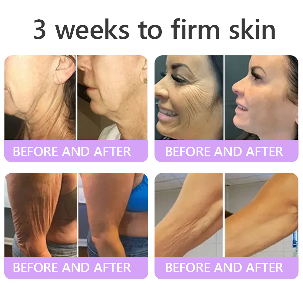 🎁HISKIN® Only 5 boxes left! We're offering you an additional 30% discount! Get yourself in shape and healthy. Miss out now, and you won't have another chance until next year.
