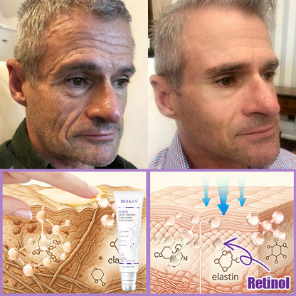 🎁HISKIN® Only 5 boxes left! We're offering you an additional 30% discount! Get yourself in shape and healthy. Miss out now, and you won't have another chance until next year.